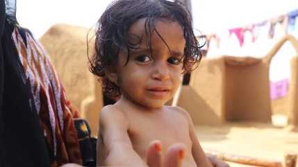  Hunger in yemen