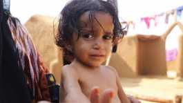  Hunger in yemen